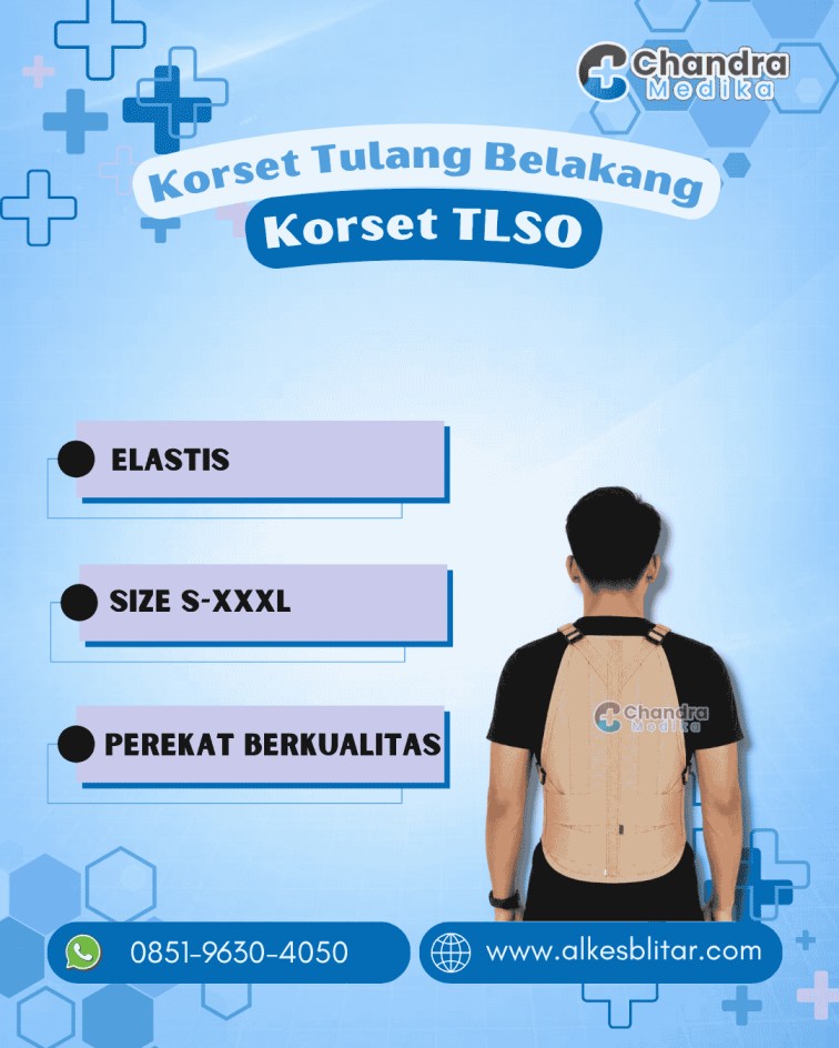 Korset TLSO Lumbal Fisioterapi Apa Itu Korset TLSO Lumbal? Korset TLSO Lumbal merupakan alat penyangga tulang belakang yang dirancang untuk memberikan stabilitas pada area dada (thoracic), pinggang (lumbar), dan tulang belakang bagian bawah. TLSO sendiri merupakan singkatan dari Thoraco Lumbo Sacral Orthosis, yaitu jenis ortosis yang berfungsi membatasi gerakan tulang belakang agar proses penyembuhan dapat berlangsung secara optimal. Korset ini sering direkomendasikan oleh dokter ortopedi, dokter rehabilitasi medik, maupun fisioterapis untuk membantu pasien yang mengalami gangguan pada tulang belakang. Dibandingkan korset elastis biasa, TLSO memiliki struktur yang lebih kokoh sehingga mampu memberikan dukungan yang lebih maksimal. Selain digunakan setelah tindakan operasi, korset TLSO lumbal juga dapat membantu mengurangi rasa nyeri akibat cedera, kelainan postur, maupun penyakit degeneratif pada tulang belakang. Fungsi Korset TLSO Lumbal Korset TLSO memiliki berbagai fungsi penting, diantaranya : 1. Menstabilkan Tulang Belakang Fungsi utama TLSO adalah menjaga posisi tulang belakang agar tetap stabil. Dengan gerakan yang lebih terkontrol, risiko cedera lanjutan dapat diminimalkan. 2. Mengurangi Nyeri Pinggang Banyak penderita nyeri punggung bawah merasakan perbaikan setelah menggunakan TLSO sesuai anjuran tenaga medis. Dukungan pada otot dan tulang belakang membantu mengurangi tekanan pada area yang mengalami cedera. 3. Membantu Proses Penyembuhan Saat terjadi patah tulang, cedera ligamen, atau pascaoperasi tulang belakang, tubuh membutuhkan kondisi yang stabil agar jaringan dapat pulih dengan baik. TLSO membantu menciptakan kondisi tersebut. 4. Memperbaiki Postur Tubuh Beberapa orang mengalami kebiasaan membungkuk saat duduk maupun berdiri. Penggunaan TLSO dapat membantu menjaga posisi tubuh tetap tegak sehingga postur menjadi lebih baik. 5. Mencegah Gerakan Berlebihan Gerakan memutar, membungkuk, atau mengangkat beban berat dapat memperparah kondisi tulang belakang. TLSO membantu membatasi gerakan tersebut sehingga risiko cedera semakin kecil. Keunggulan Korset TLSO Lumbal Mengapa banyak tenaga medis memilih TLSO dibandingkan korset biasa? Berikut beberapa kelebihannya. Dukungan yang Lebih Maksimal Material yang digunakan lebih kuat sehingga mampu menopang tulang belakang secara optimal. Desain Ergonomis Banyak model TLSO modern dibuat mengikuti bentuk anatomi tubuh sehingga tetap nyaman digunakan dalam aktivitas sehari-hari. Tali Pengencang yang Dapat Disesuaikan Pengguna dapat mengatur tingkat kekencangan sesuai kebutuhan tanpa mengurangi kenyamanan. Material Nyaman Sebagian besar TLSO menggunakan bahan yang cukup ringan, memiliki sirkulasi udara baik, dan tidak mudah membuat kulit terasa panas. Dapat Digunakan dalam Jangka Waktu Tertentu Dengan pengawasan dokter, TLSO dapat digunakan selama masa pemulihan tanpa mengganggu aktivitas ringan. Cara Menggunakan Korset TLSO Lumbal dengan Benar Penggunaan yang tepat akan meningkatkan efektivitas TLSO. Berikut langkah-langkahnya: Gunakan pakaian tipis sebelum memakai korset untuk mengurangi gesekan pada kulit. Letakkan TLSO sesuai posisi tulang belakang. Kencangkan tali secara bertahap hingga terasa pas. Pastikan tidak terlalu longgar maupun terlalu ketat. Duduk dan berdiri beberapa kali untuk memastikan posisi tetap nyaman. Ikuti durasi penggunaan sesuai anjuran dokter. Hindari mengencangkan korset secara berlebihan karena dapat mengganggu sirkulasi darah maupun kenyamanan bernapas. Tips Merawat Korset Perawatan yang baik akan membuat korset lebih awet dan tetap higienis. Bersihkan secara rutin sesuai petunjuk produk. Gunakan sabun lembut saat mencuci bagian berbahan kain. Hindari penggunaan pemutih. Keringkan di tempat teduh. Simpan di tempat yang bersih dan kering. Periksa kondisi perekat serta tali pengencang secara berkala. Perawatan yang tepat juga membantu menjaga fungsi penyangga tetap optimal. Hal yang Perlu Diperhatikan Sebelum Membeli Korset TLSO Sebelum membeli korset TLSO, pertimbangkan beberapa hal berikut: 1. Pilih Ukuran yang Tepat Ukuran sangat menentukan kenyamanan. TLSO yang terlalu besar tidak akan memberikan stabilisasi maksimal, sedangkan ukuran yang terlalu kecil dapat menyebabkan rasa tidak nyaman. 2. Sesuaikan dengan Kondisi Medis Setiap pasien memiliki kebutuhan berbeda. Ada TLSO dengan penyangga tambahan pada dada, ada pula yang lebih fokus pada area pinggang. 3. Perhatikan Kualitas Material Pilih bahan yang kuat, nyaman, dan tahan lama agar dapat digunakan selama masa terapi. 4. Konsultasikan dengan Tenaga Medis Dokter atau fisioterapis dapat membantu menentukan jenis TLSO yang paling sesuai berdasarkan diagnosis dan kondisi pasien. Wujudkan Pemulihan Lebih Optimal dengan Korset TLSO Lumbal dari Chandra Medika Blitar Sedang mencari Korset TLSO Lumbal yang nyaman, berkualitas, dan sesuai rekomendasi medis? Percayakan kebutuhan alat kesehatan Anda kepada Chandra Medika Blitar. Kami menyediakan korset TLSO lumbal dengan material berkualitas, desain ergonomis, dan berbagai pilihan ukuran untuk membantu memberikan dukungan optimal selama proses pemulihan tulang belakang. Hubungi Chandra Medika Blitar sekarang untuk mendapatkan informasi produk dan konsultasi mengenai pemilihan korset TLSO lumbal yang sesuai dengan kebutuhan Anda. Dengan produk yang tepat dan pelayanan yang profesional, Anda dapat menjalani proses pemulihan dengan lebih nyaman, aman, dan optimal.